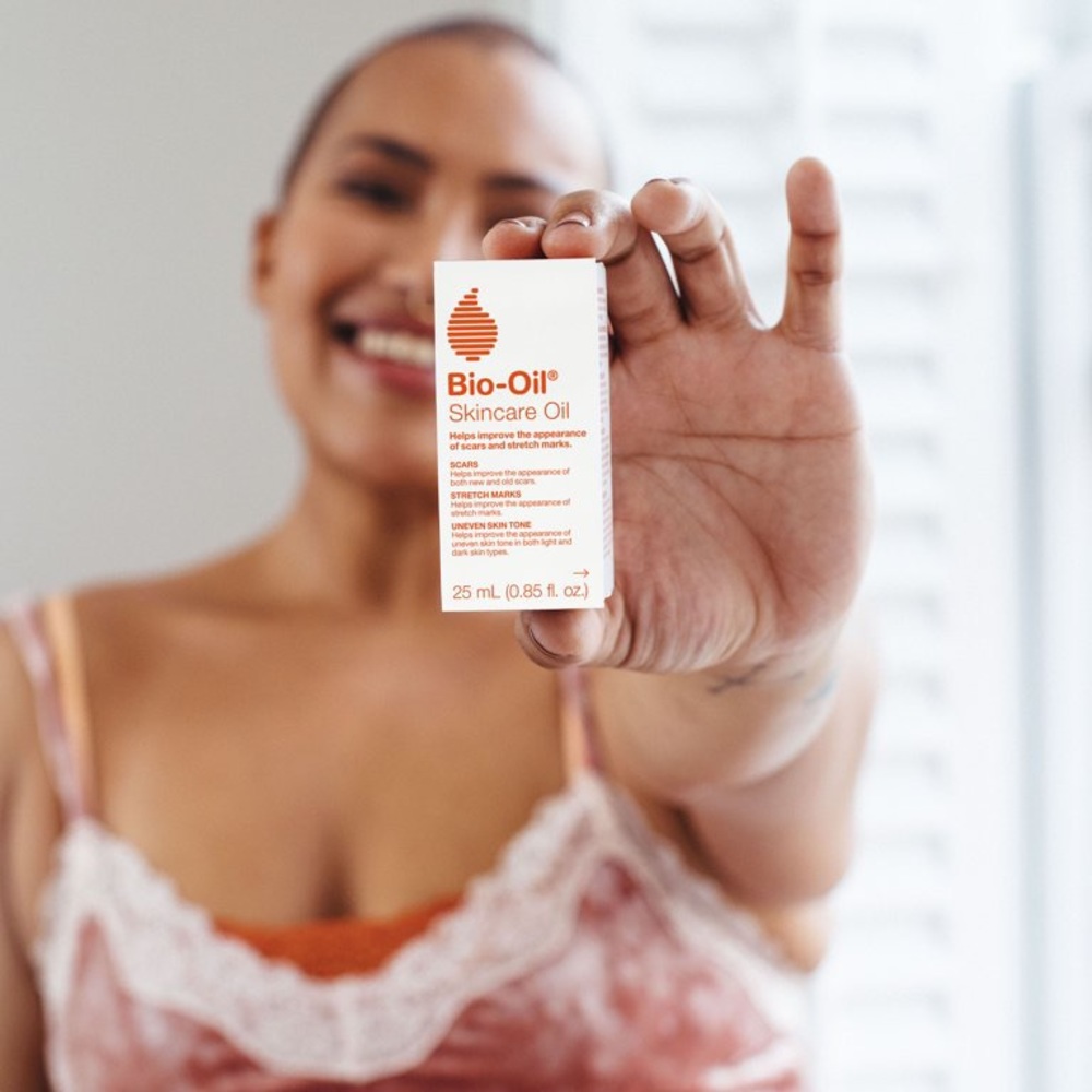 Bio-Oil Skincare Oil, 2 Ounce, Body Oil and Dark Spot Corrector for Scars
